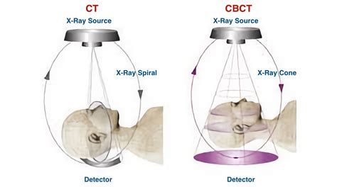 difference between ct and cbct.